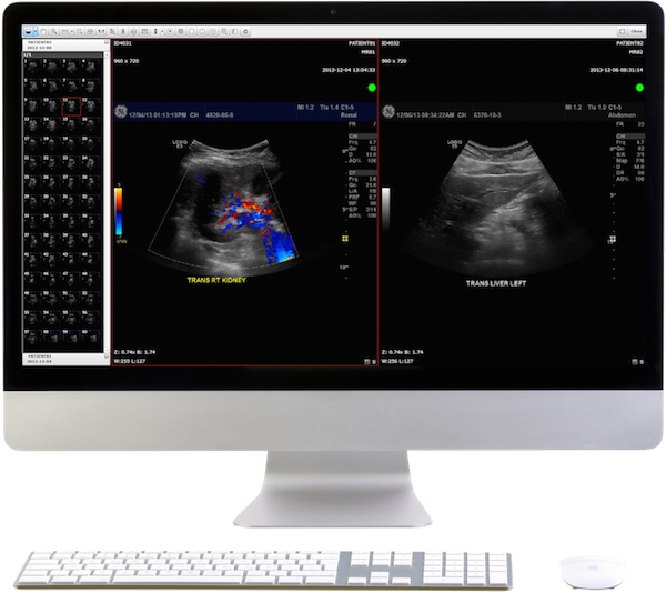 Medical image sharing with ultrasound